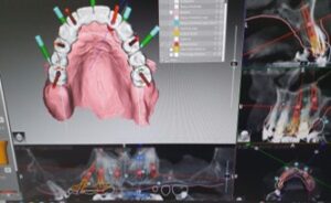 Total Digital Concept